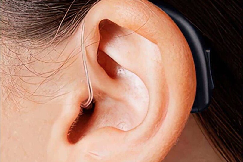 Hearing Aids Prices